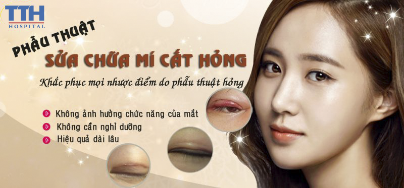 Cắt mí mắt sửa lại